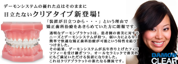 審美性の高いデーモンシステムクリアタイプ新登場